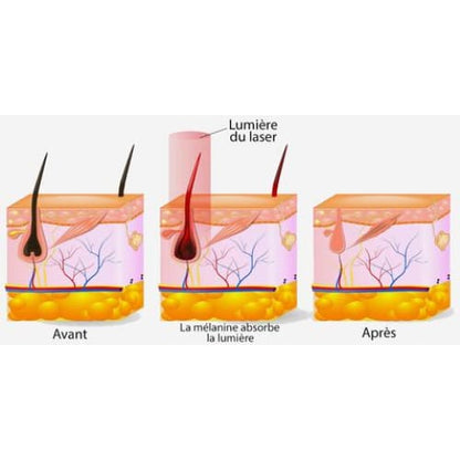 épilateur à Lumière Pulsée Intense Ipl Visage Et Corps
